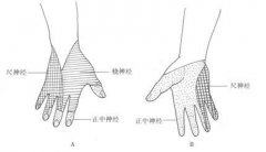 尺神经损伤后如何治疗？点开告诉你！