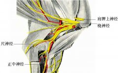 什么是桡神经损伤，要怎么治疗？