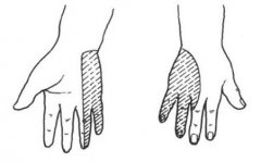 什么是尺神经损伤？