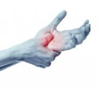 肘管综合征——“爪形手”的元凶