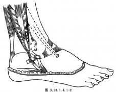 腓总神经损伤，你需要了解这些~