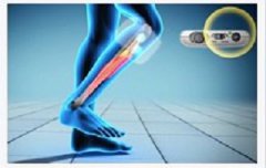 腓总神经损伤能恢复吗