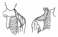 腋神经损伤术后恢复