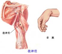 为什么会出现手腕下垂？手腕下垂怎么治